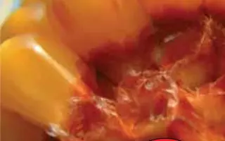 ААСПИД / AASPEED