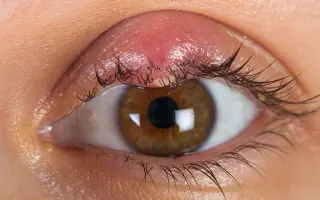 КОТЛАССКИЙ