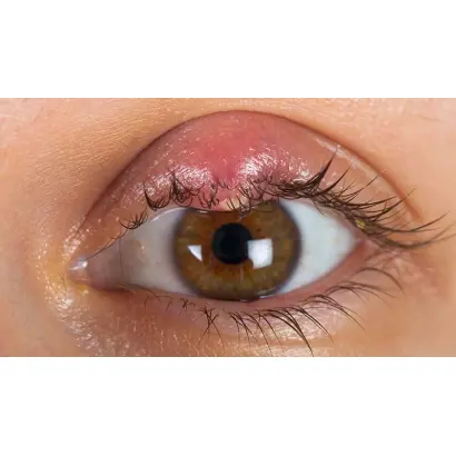 КОТЛАССКИЙ